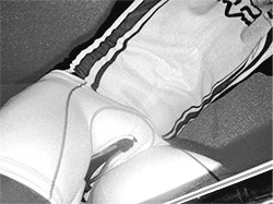 selim-disfuncao-eretil-06